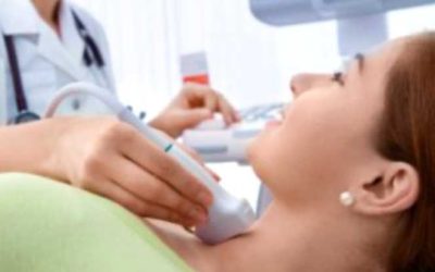 Cytoponction de Thyroïde